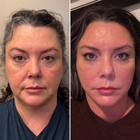 Guía de Drenaje Linfático Facial en Casa — El Método de 90 Segundos